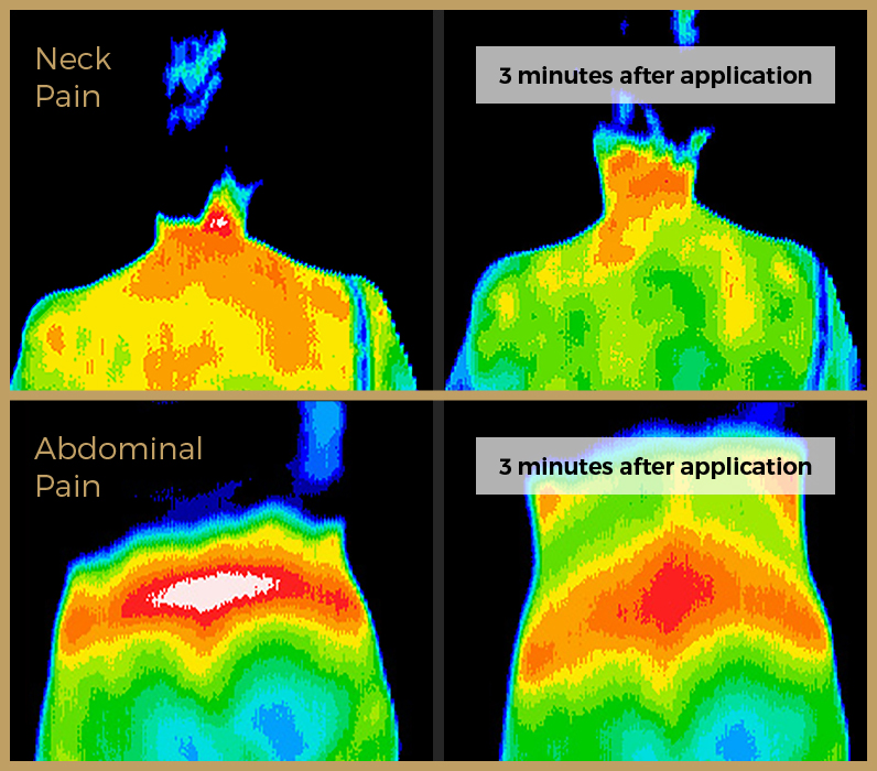 Thermal Imaging validates that essential oils can have a dramatic effect on the management of pain in the human body.